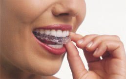 Invisalign