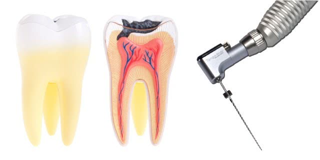 Endodontia