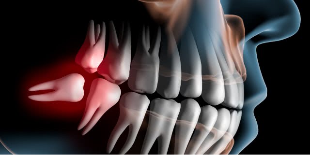 Cirurgia Oral