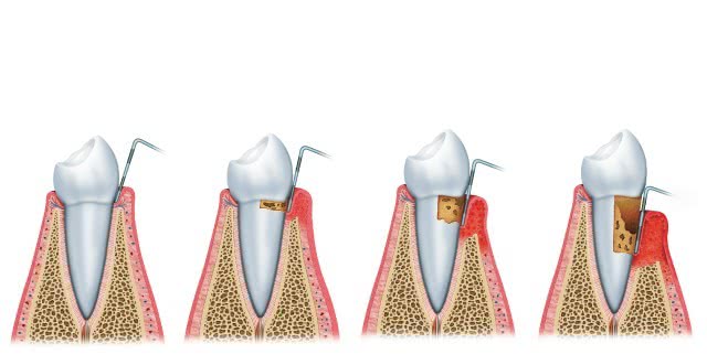 Periodontologia